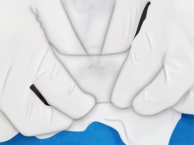 従来の治療方法 手順6