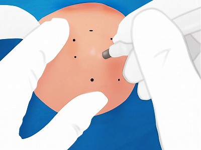 くり抜き法 手順3