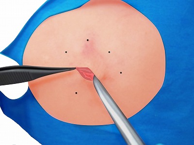 くり抜き法 手順7